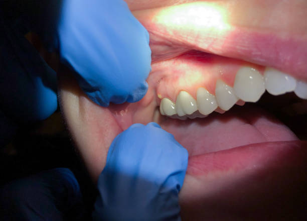 Best After-Hours Emergency Dentist in Marceline, MO